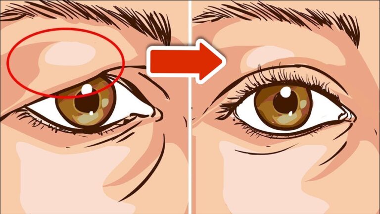 5 einfache Tricks für sofortige Wirkung gegen hängende Augenlider!
