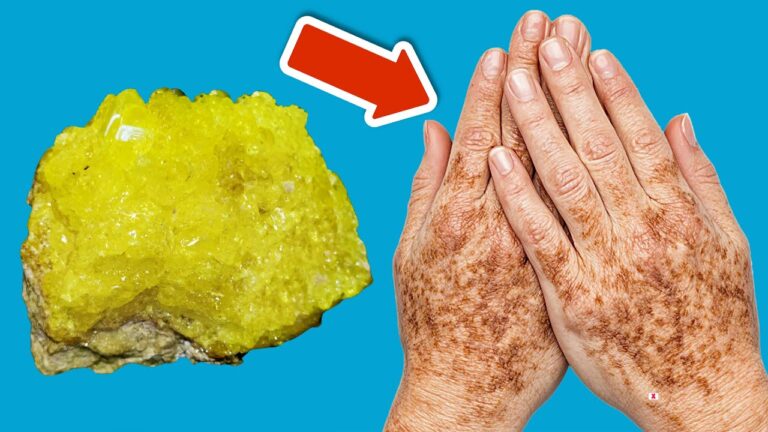 Entferne 3 Altersflecken mit diesem einfachen Mineral und erlebe den Unterschied!