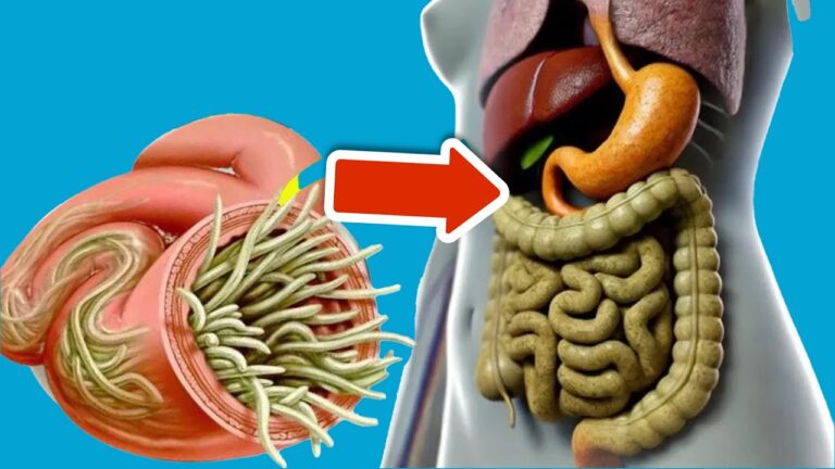 6 Lebensmittel, um Parasiten in Minuten aus deinem Darm zu spülen!