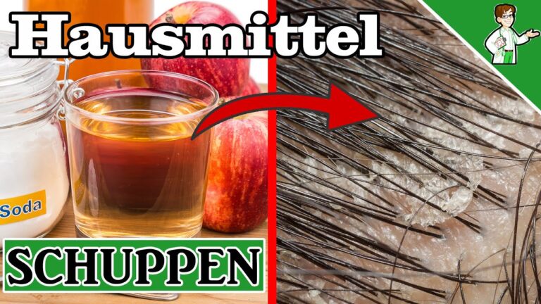 7 effektive Hausmittel gegen Schuppen für ein gesundes Haargefühl