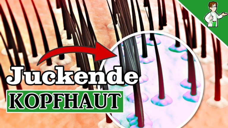 12 Tipps gegen juckende Kopfhaut für sofortige Linderung und gesundes Haar!