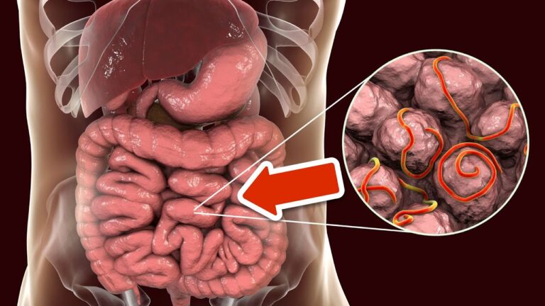 1 Tasse täglich befreit dich für immer von Parasiten – entdecke das Geheimnis!